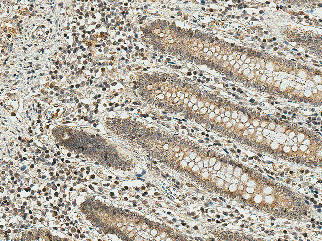  - SMAD3 Antibody ASM10578